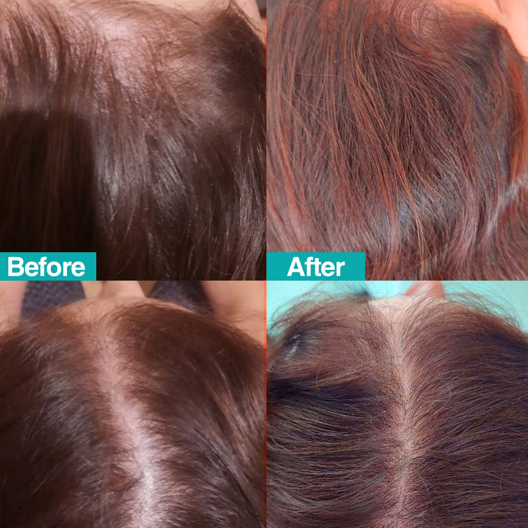 HairActCare Anti-Hair Loss vials 70ml